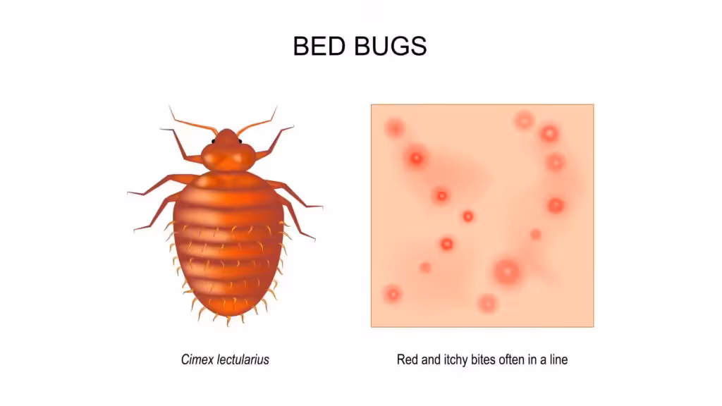 Bed bug bite picture